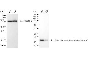 Western blotting analysis using eukaryotic translation initiation factor 5A antibody (ABIN7798534).