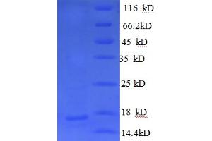 Neurofascin (NFASC) (AA 1239-1347) protein (His tag)