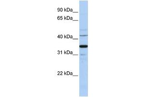 WB Suggested Anti-WNT5A Antibody Titration:  1 ug/ml  Positive Control:  Hela cell lysate WNT5A is strongly supported by BioGPS gene expression data to be expressed in Human HeLa cells (WNT5A antibody  (Middle Region))