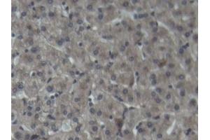 Detection of C3 in Porcine Liver Tissue using Polyclonal Antibody to Complement Component 3 (C3) (C3 antibody  (AA 23-300))