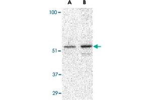 Western blot analysis of PLIN3 in Daudi cell lysate with PLIN3 polyclonal antibody  at (A) 0.