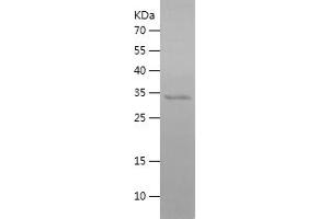 Western Blotting (WB) image for Hepcidin Antimicrobial Peptide (HAMP) (AA 24-84) protein (His-IF2DI Tag) (ABIN7283608) (Hepcidin Protein (AA 24-84) (His-IF2DI Tag))