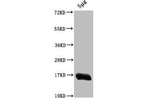 Western Blot Positive WB detected in: Escherichia coli lysate All lanes: HNS antibody at 1:2000 Secondary Goat polyclonal to rabbit IgG at 1/50000 dilution Predicted band size: 16 kDa Observed band size: 16 kDa (HNS (AA 2-137) antibody)