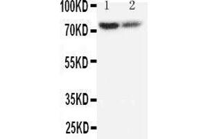 Anti-PMP70 antibody, Western blotting Lane 1: Rat Lung Tissue Lysate Lane 2: Rat Ovary Tissue Lysate