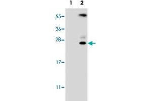 Western blot analysis of KLK6 (arrow) using KLK6 polyclonal antibody . (Kallikrein 6 antibody  (N-Term))
