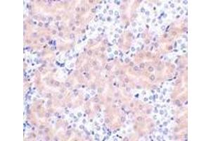 Immunohistochemistry of Bfl-1 in mouse kidney tissue with Bfl-1 antibody at 2 μg/ml. (BCL2A1 antibody  (N-Term))