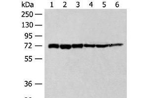 Western blot analysis of 293T cell Human fetal brain tissue Jurkat cell Hela cell Mouse heart tissue lysates using TCF25 Polyclonal Antibody at dilution of 1:250 (TCF25 antibody)