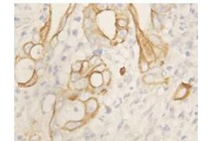 Immunohistochemistry with TNFR2 Polyclonal Antibody