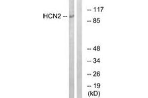 Western blot analysis of extracts from Jurkat cells, using HCN2 Antibody. (HCN2 antibody  (AA 491-540))