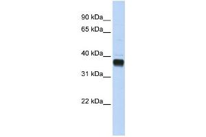 Western Blotting (WB) image for anti-Nudix (Nucleoside Diphosphate Linked Moiety X)-Type Motif 18 (NUDT18) antibody (ABIN2459244) (NUDT18 antibody)