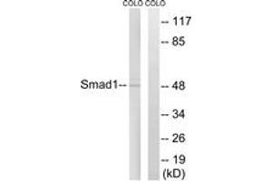 Western blot analysis of extracts from COLO cells, treated with EGF 200ng/ml 30', using Smad1 (Ab-465) Antibody. (SMAD1 antibody  (AA 416-465))