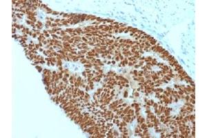 Immunohistochemistry (IHC) image for anti-Caudal Type Homeobox 2 (CDX2) (AA 150-249) antibody (ABIN4949546)
