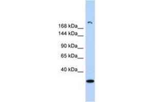 Image no. 1 for anti-Ubiquitously Transcribed Tetratricopeptide Repeat Gene, Y-Linked (UTY) (AA 971-1020) antibody (ABIN6742129) (UTY antibody  (AA 971-1020))