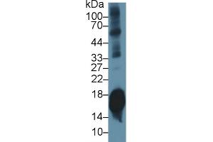 Detection of SNCa in Mouse Cerebrum lysate using Polyclonal Antibody to Synuclein Alpha (SNCa) (SNCA antibody  (AA 23-140))