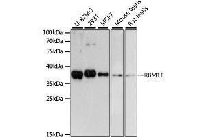 Western blot analysis of extracts of various cell lines, using RBM11 antibody (ABIN6133082, ABIN6146756, ABIN6146757 and ABIN6217133) at 1:3000 dilution. (RBM11 antibody  (AA 1-281))