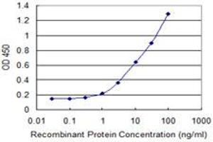 Detection limit for recombinant GST tagged LSM1 is 0. (LSM1 antibody  (AA 34-133))