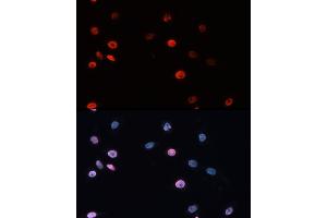 Immunofluorescence analysis of HeLa cells using DNMT3B Rabbit pAb (ABIN3016943, ABIN3016944, ABIN3016945 and ABIN6219896) at dilution of 100 (40x lens). (DNMT3B antibody)