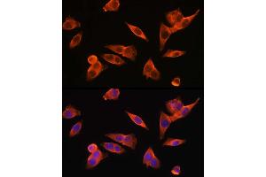 Immunofluorescence analysis of HepG2 cells using TLR4 Rabbit pAb (ABIN6134488, ABIN6149222, ABIN6149225 and ABIN6215119) at dilution of 1:150 (40x lens). (TLR4 antibody  (AA 500-600))