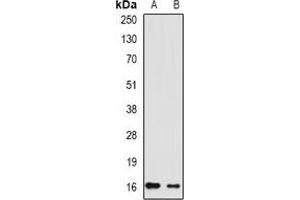 Western blot analysis of RHEB expression in Hela (A), Raji (B) whole cell lysates. (RHEB antibody)