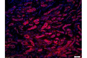 Formalin-fixed and paraffin-embedded human kidney labeled with Anti-phospho-MLC(Ser20) /Myosin light chain(Ser20) Polyclonal Antibody, Unconjugated (ABIN872283) 1:200, overnight at 4°C, The secondary antibody was Goat Anti-Rabbit IgG, Cy3 conjugated used at 1:200 dilution for 40 minutes at 37°C. (MYL9 antibody  (pSer20))