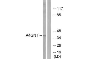 Western blot analysis of extracts from K562 cells, using A4GNT antibody. (A4GNT antibody  (Internal Region))