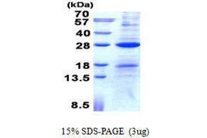 Figure annotation denotes ug of protein loaded and % gel used. (AICDA Protein)