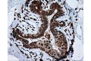 Immunohistochemical staining of paraffin-embedded breast tissue using anti-TPMT mouse monoclonal antibody.