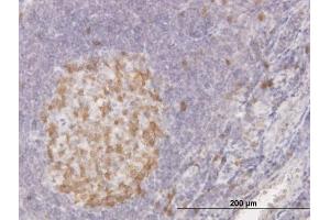 Immunoperoxidase of monoclonal antibody to CDC2 on formalin-fixed paraffin-embedded human tonsil. (CDK1 antibody  (AA 211-297))