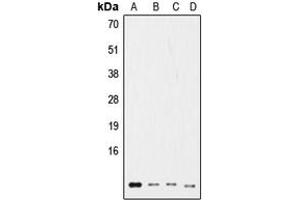 Western blot analysis of Ub expression in HeLa (A), NIH3T3 (B), rat kidney (C), HL60 (D) whole cell lysates. (Ubiquitin antibody  (Center))