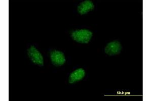 Immunofluorescence of purified MaxPab antibody to RIP on HeLa cell. (RPAIN antibody  (AA 1-219))
