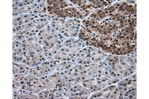 Immunohistochemical staining of paraffin-embedded liver tissue using anti-ERCC1 mouse monoclonal antibody. (ERCC1 antibody)