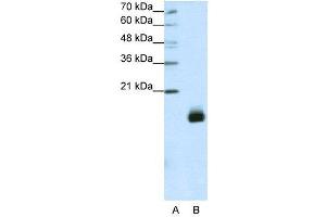 WB Suggested Anti-RPS14  Antibody Titration: 1. (RPS14 antibody  (N-Term))