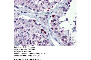 Immunohistochemistry with Human Testis lysate tissue (NFX1 antibody  (Middle Region))