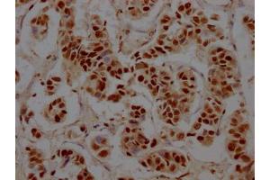 Immunohistochemistry (IHC) image for anti-Retinoblastoma Binding Protein 4 (RBBP4) antibody (ABIN7127789)