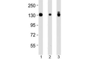 Western blot testing of Integrin alpha 3 antibody at 1:4000 dilution and 1) A431 lysate, 2) HeLa lysate, and 3) PC3 lysate at 1:2000. (ITGA3 antibody  (N-Term))