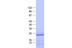 Validation with Western Blot