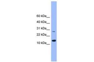 Image no. 1 for anti-Glutaredoxin 2 (GRX2) (AA 91-141) antibody (ABIN6745473)