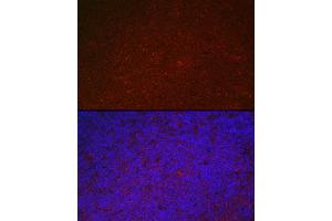 Immunofluorescence analysis of mouse spleen using LILRB4 Rabbit pAb (ABIN6131872, ABIN6143221, ABIN6143222 and ABIN6222869) at dilution of 1:100 (40x lens). (LILRB4 antibody  (AA 22-259))