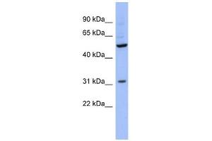 RBMS3 antibody used at 1 ug/ml to detect target protein.