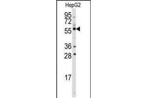 Western blot analysis of anti-ALDH4A1 Antibody in HepG2 cell line lysates (35ug/lane). (ALDH4A1 antibody  (C-Term))