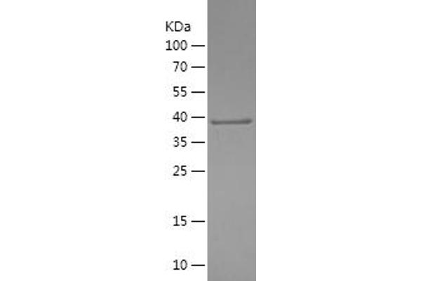 PI4KB Protein (AA 1-128) (His-IF2DI Tag)
