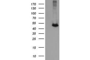 Image no. 2 for anti-Chromosome 2 Open Reading Frame 62 (C2orf62) antibody (ABIN1497052)