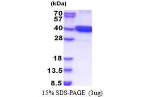 SDS-PAGE (SDS) image for Cyclin-Dependent Kinase 16 (CDK16) (AA 158-496) protein (His tag) (ABIN5853364)