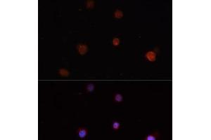 Immunofluorescence analysis of THP-1 cells using NLRC4 Polyclonal Antibody (NLRC4 antibody)