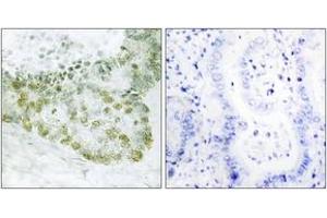 Immunohistochemistry (IHC) image for anti-Transforming Growth Factor beta 1 Induced Transcript 1 (TGFB1I1) (AA 31-80) antibody (ABIN1532675)
