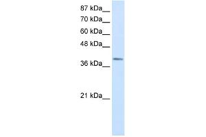 WB Suggested Anti-LMX1A Antibody Titration:  0. (LMX1A antibody  (Middle Region))