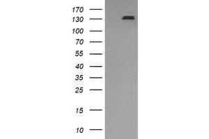 Image no. 1 for anti-Platelet Derived Growth Factor Receptor beta (PDGFRB) antibody (ABIN1500102) (PDGFRB antibody)