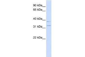KCNRG antibody used at 1 ug/ml to detect target protein. (KCNRG antibody  (N-Term))