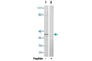 Western blot analysis of extracts from HeLa cells, using RBMX polyclonal antibody .