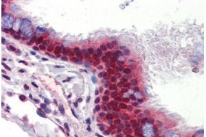 Human Lung, Respiratory Epithelium (formalin-fixed, paraffin-embedded) stained with UBQLN1 antibody ABIN462260 followed by biotinylated goat anti-rabbit IgG secondary antibody ABIN481713, alkaline phosphatase-streptavidin and chromogen. (Ubiquilin 1 antibody  (AA 290-339))